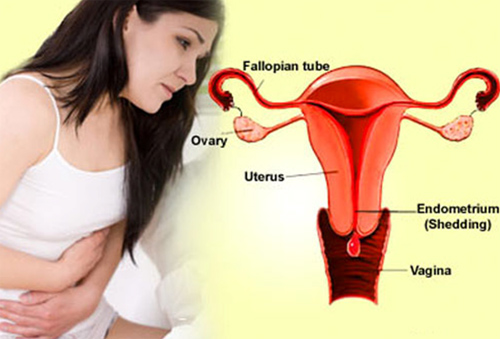 Các giai đoạn của ung thư cổ tử cung như thế nào