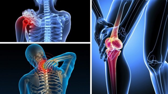 Các loại cây chữa bệnh xương khớp an toàn hiệu quả