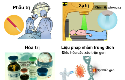 Các phương pháp điều trị ung thư hiện nay là gì
