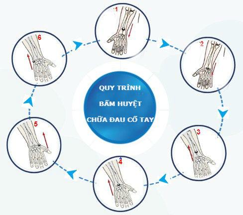 Cách bấm huyệt chữa đau khớp cổ tay hiệu quả