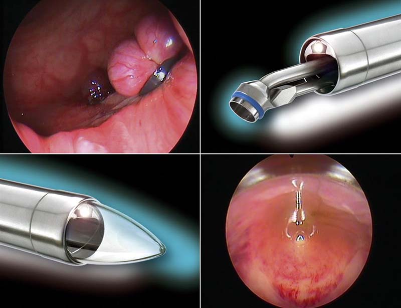 Cách chữa bệnh tại nhà giai đoạn đầu an toàn hiệu quả