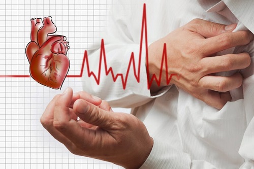cách chữa bệnh tim đập nhanh an toàn hiệu quả