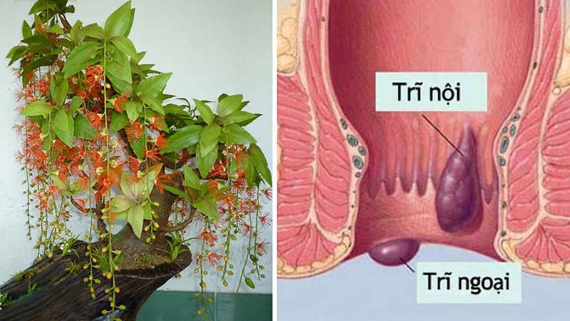 Cách chữa bệnh trĩ bằng cây lộc vừng an toàn hiệu quả