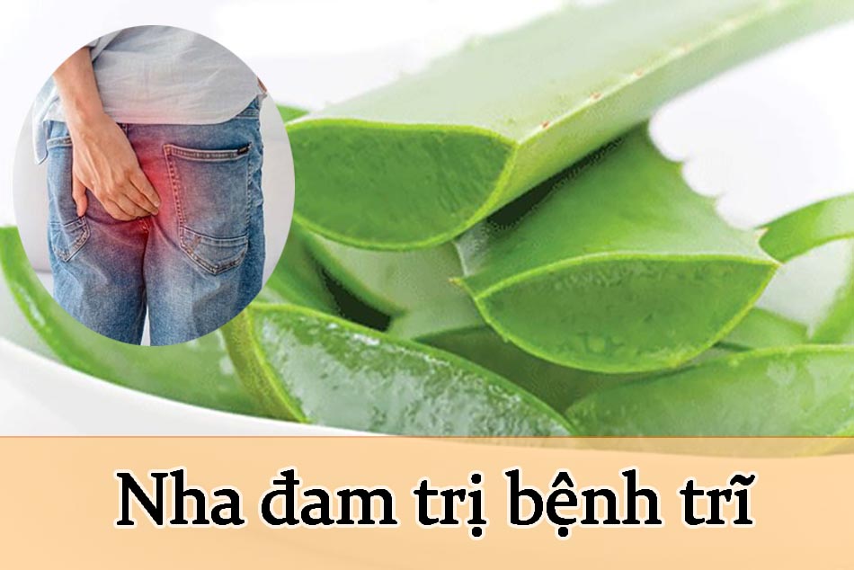 Cách chữa bệnh trĩ bằng nha đam an toàn hiệu quả