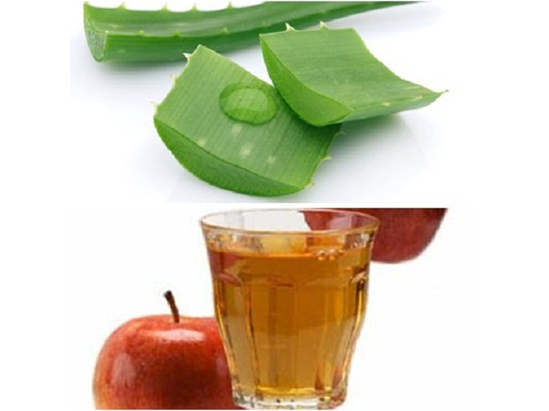Cách chữa bệnh trĩ bằng nha đam an toàn hiệu quả