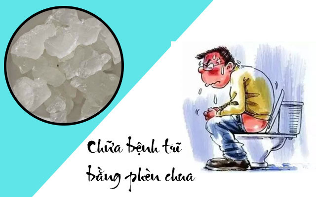 Cách chữa bệnh trĩ bằng phèn chua hiệu quả