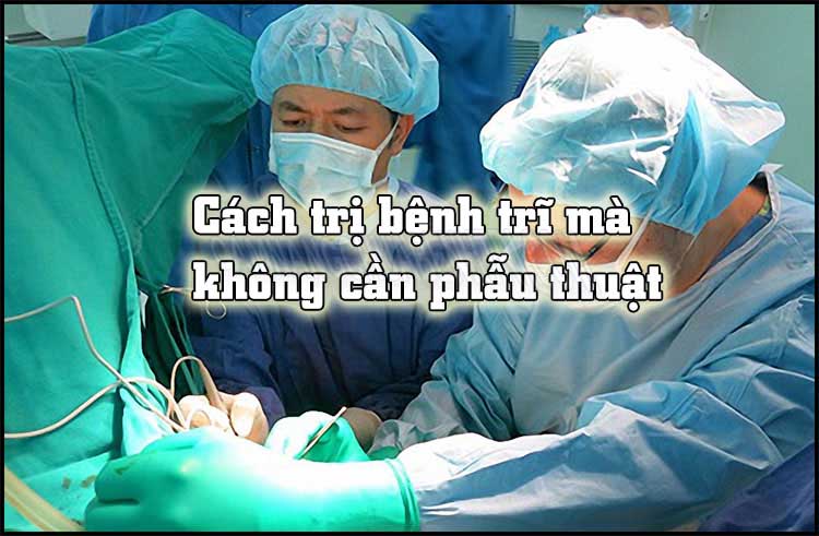 Cách chữa bệnh trĩ không cần phẫu thuật 