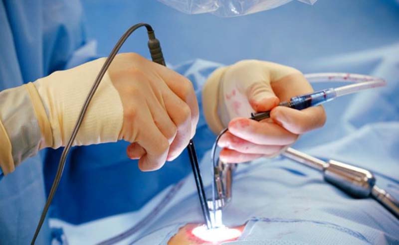 Cách chữa bệnh trĩ ngoại cấp độ 4 hiệu quả