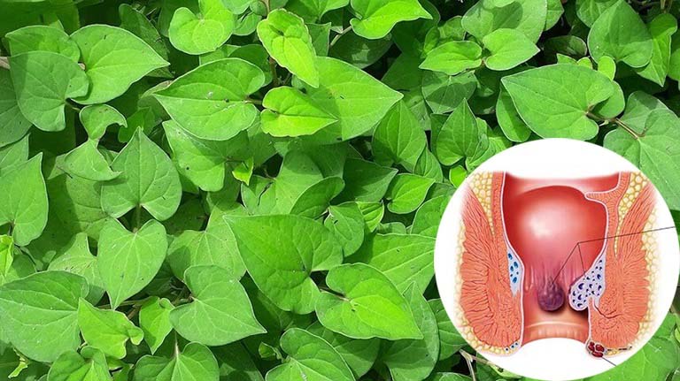 Cách chữa bệnh trĩ tại nhà bằng rau diếp cá an toàn hiệu quả