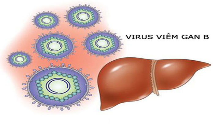 Cách chữa bệnh viêm gan B như thế nào