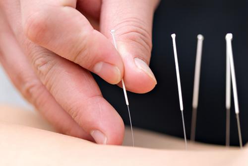 Cách chữa phì đại tuyến tiền liệt an toàn hiệu quả 