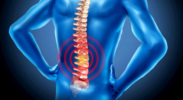 Cách chữa thoái hóa cột sống bằng dân gian như thế nào