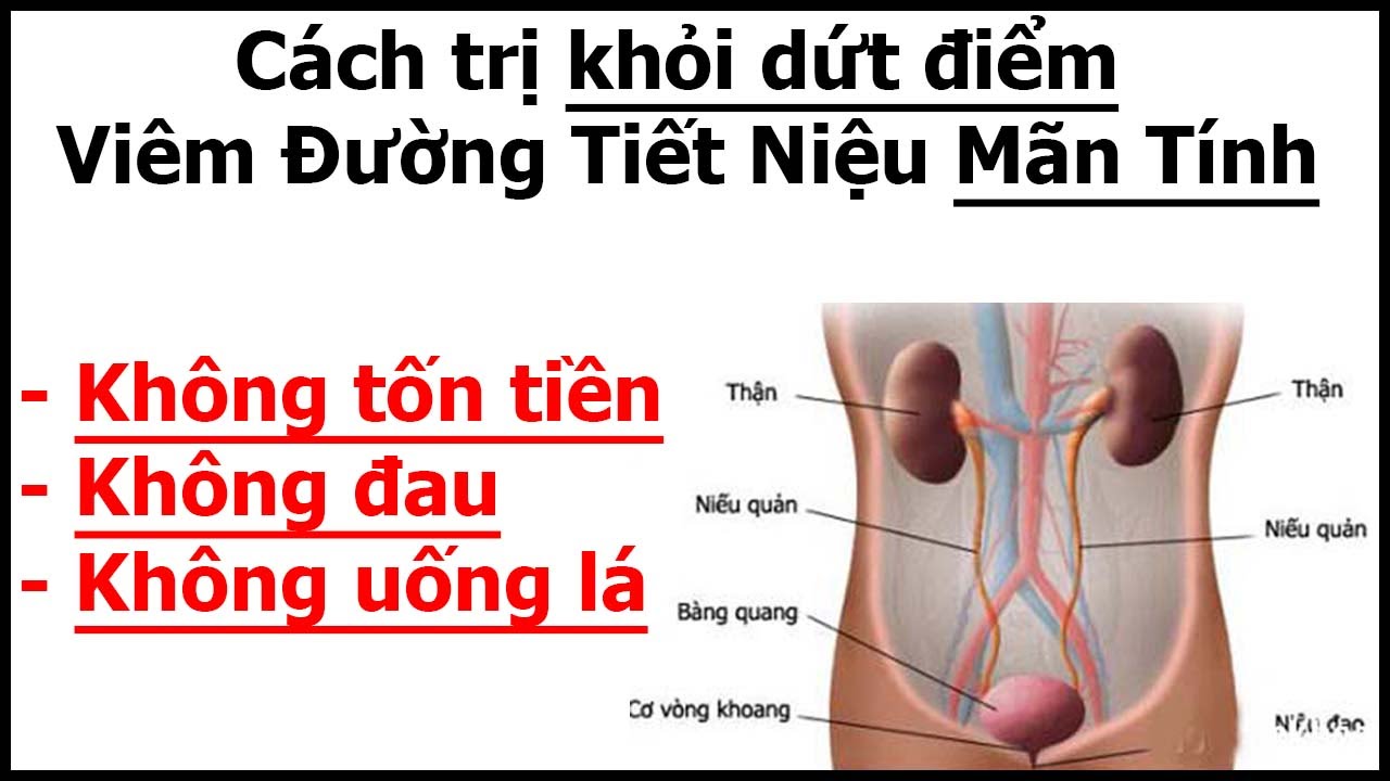 Cách chữa viêm đường tiết niệu an toàn hiệu quả