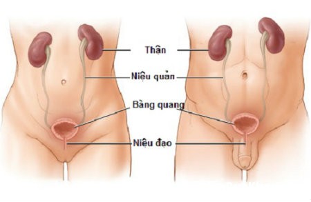 Cách chữa viêm đường tiết niệu an toàn hiệu quả