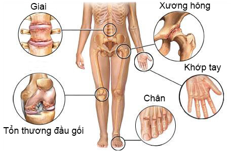 Cách điều trị đau nhức khớp tay chân an toàn hiệu qủa