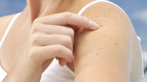 Cách làm đẹp từ mật ong và nghệ an toàn hiệu quả