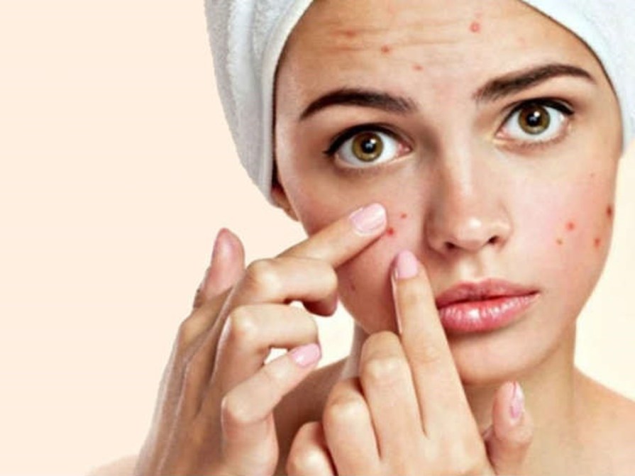 Cách làm trắng da bằng mật ong và sữa tươi an toàn hiệu quả