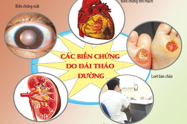 Cách phòng tránh biến chứng bệnh tiểu đường như thế nào