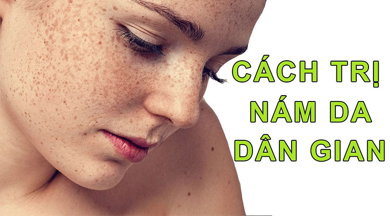 Cách trị nám da dân gian an toàn hiệu quả
