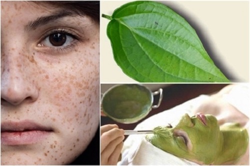 Cách trị nám da mặt bằng lá trầu không an toàn hiệu quả