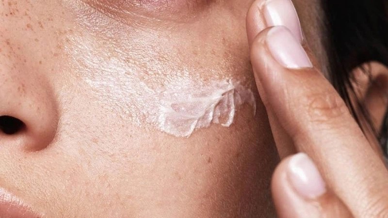 Cách trị tàn nhang bằng kem đánh răng an toàn hiệu quả