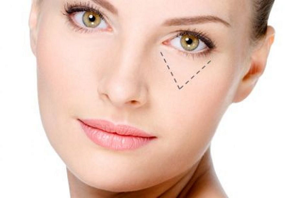 Cách xóa nếp nhăn vùng mắt an toàn hiệu quả