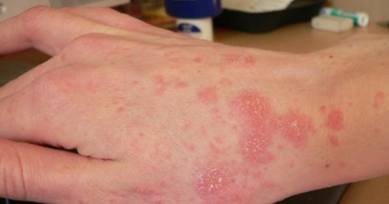 Chè vối có tác dụng gì với sức khỏe con người