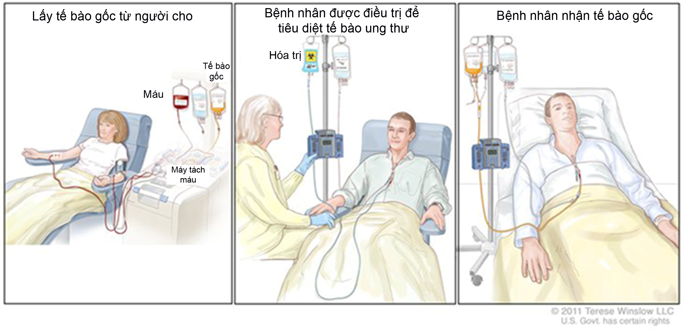 Có nên hóa trị ung thư không