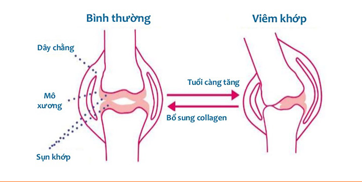 Thực phẩm chức năng bổ xương khớp của Mỹ Bi-jcare Collagen