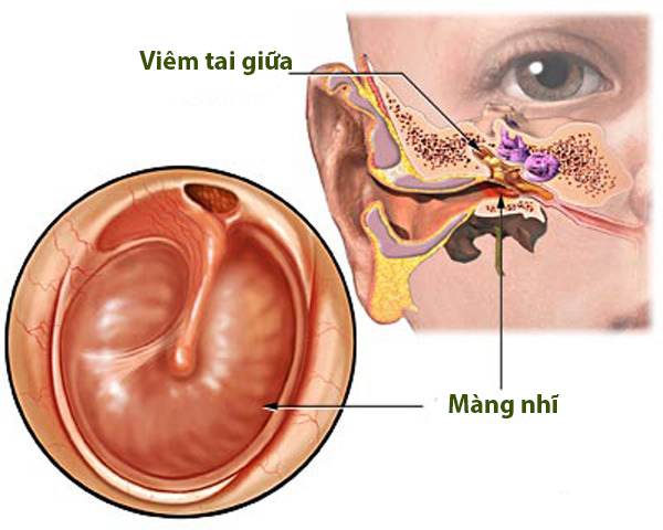 Công dụng của cây mơ lông với sức khỏe con người như thế nào