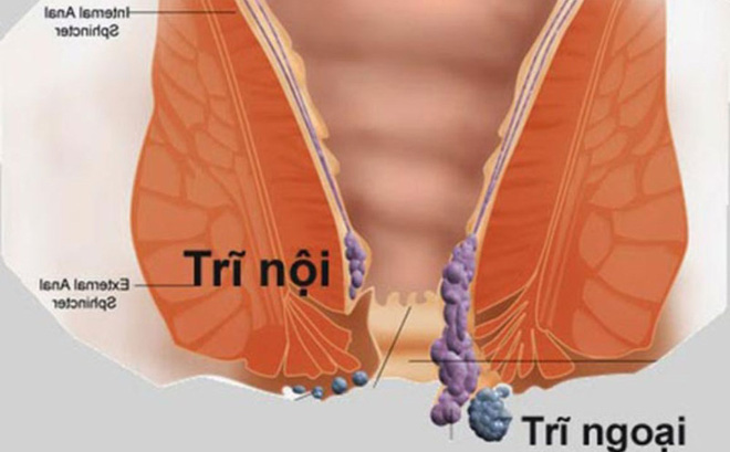 Công dụng của quả sim với sức khỏe con người như thế nào