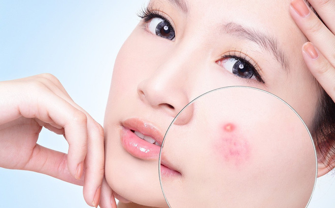 Công dụng của quả thanh long với sức khỏe con người như thế nào