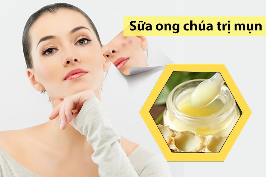 Công dụng của sữa ong chúa với da như thế nào