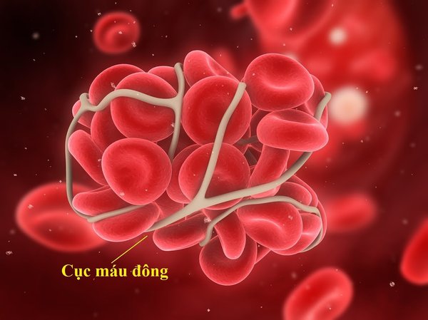 Cục máu đông
