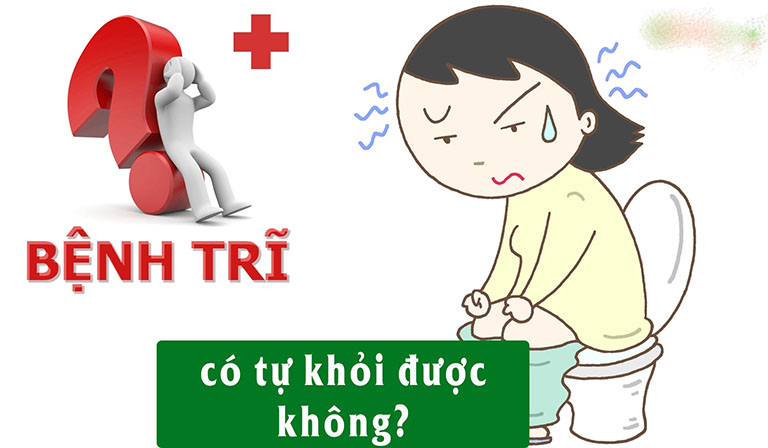 Dấu hiệu của bệnh trĩ nhẹ là gì và cách điều trị ra sao