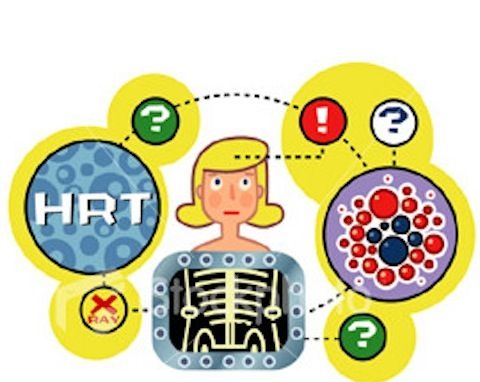 Dấu hiệu tiền mãn kinh sớm là gì và cách khắc phục ra sao