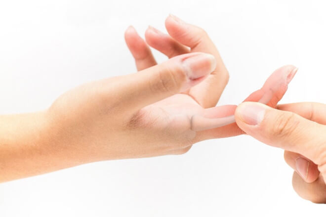 Đau khớp ngón tay trỏ là gì và cách điều trị ra sao