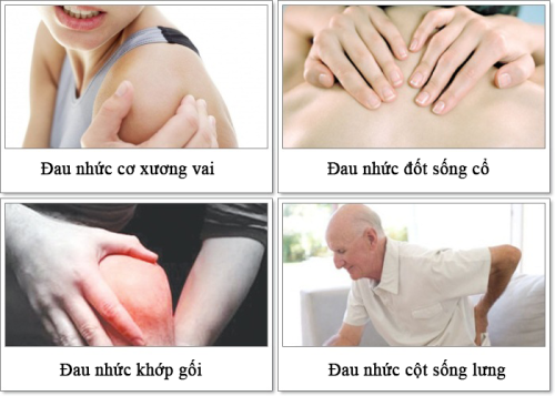 Đau nhức xương khớp không nên ăn gì tốt cho bệnh