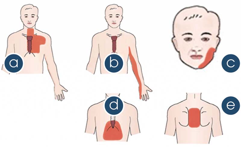 Đau thắt ngực bên trái là bệnh gì và cách điều trị ra sao