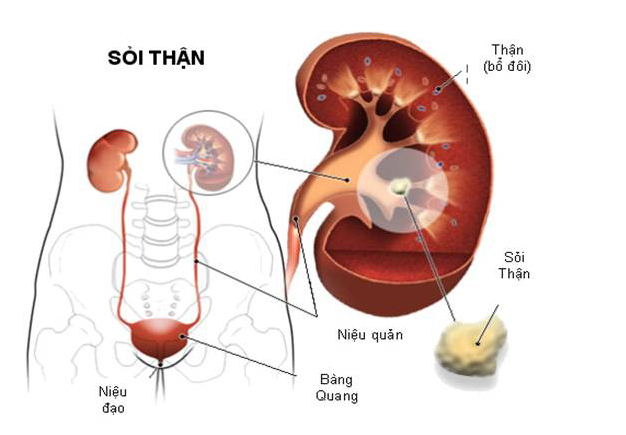 Đi tiểu đêm nhiều lần ở nam giới nguyên nhân và cách khắc phục