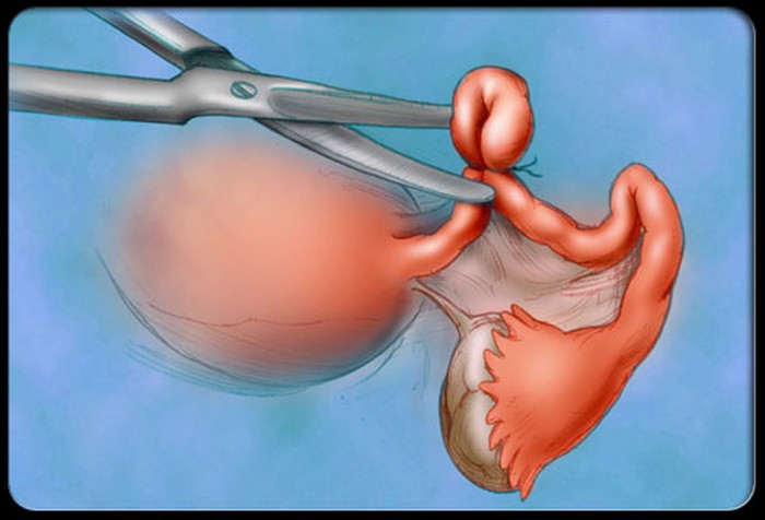 Estrogen và progesteronen là gì và có tác dụng ra sao
