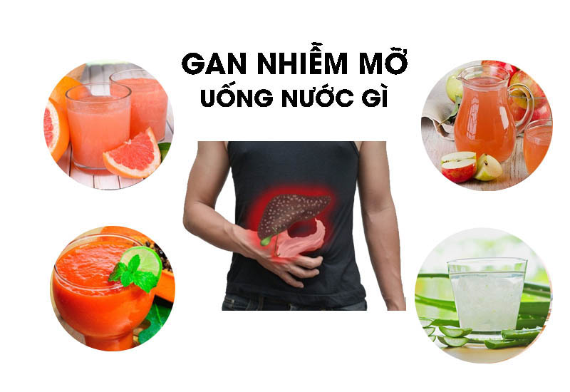 Gan nhiễm mỡ nên uống gì