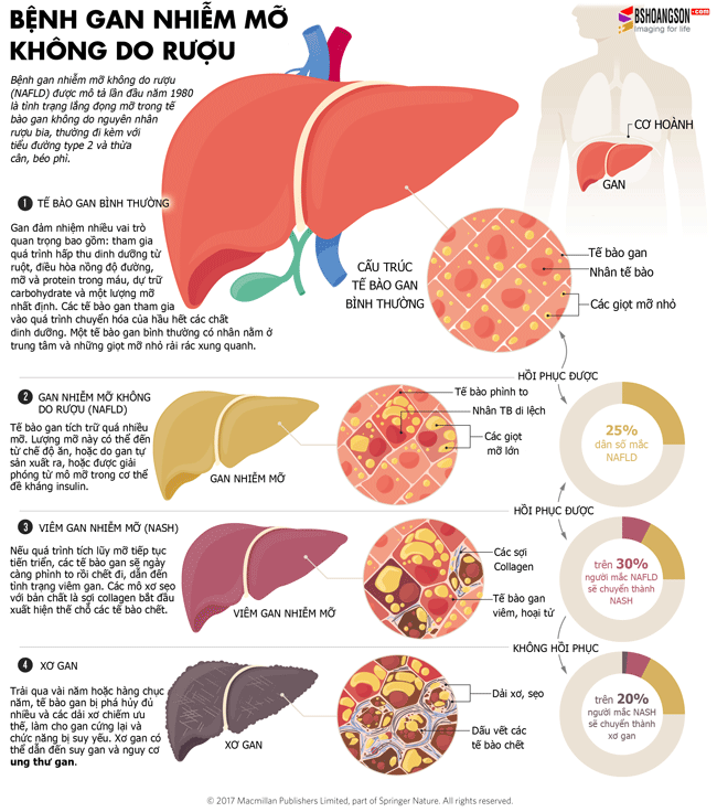 Cách chữa bệnh gan nhiễm mỡ không do rượu
