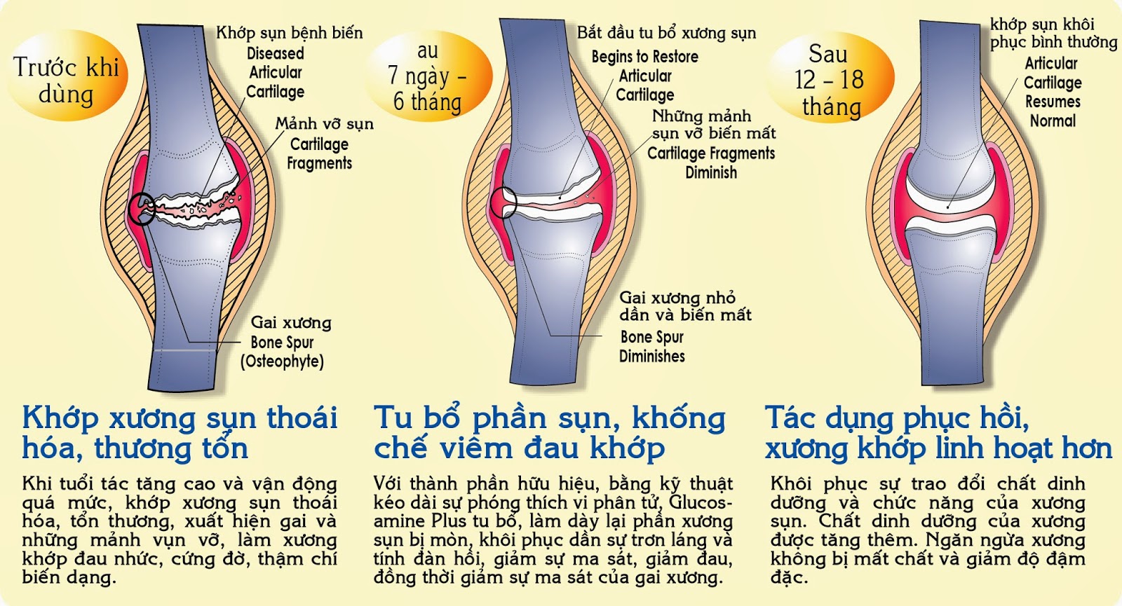 Thực phẩm chức năng bổ xương khớp của Mỹ Bi-jcare Glucosamin