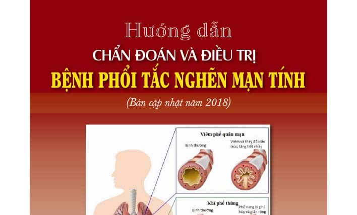 Hướng dẫn chẩn đoán và điều trị bệnh phổi tắc nghẽn mạn tính của Bộ Y tế 