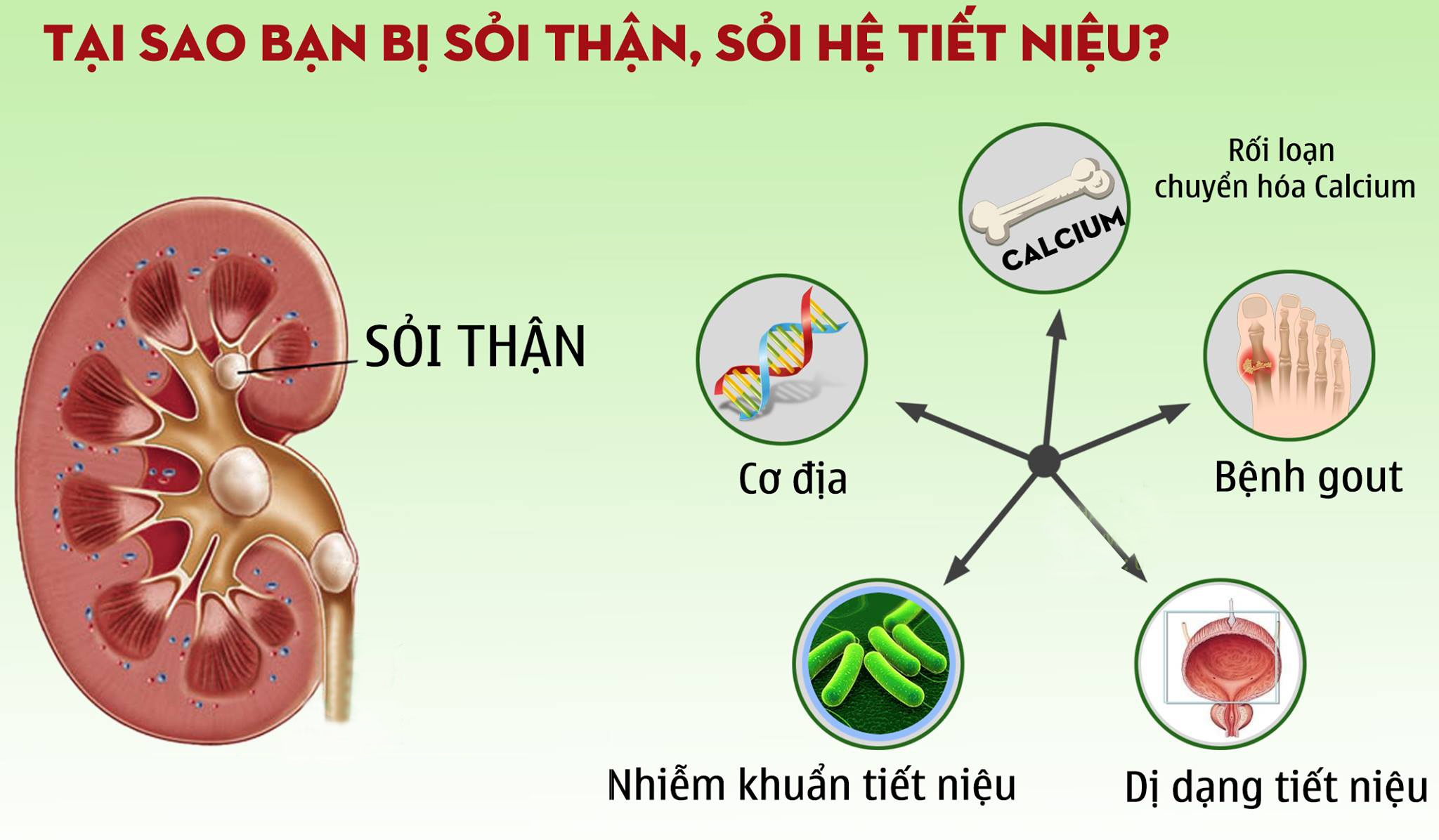 các thực phẩm đánh tan sỏi thận