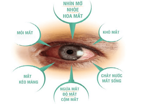 Mắt mờ uống thuốc gì hết