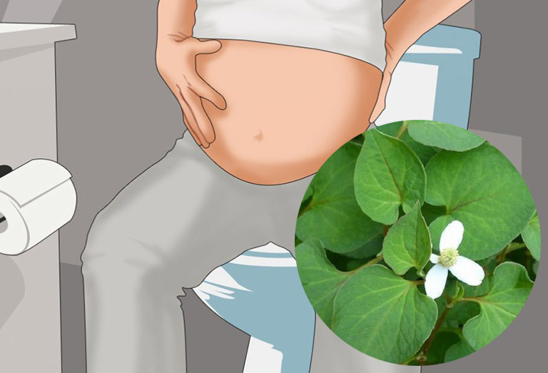 Mẹo chữa bệnh trĩ cho bà bầu an toàn hiệu quả