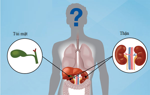 Mối liên hệ giữa Sỏi gan, mật  và Thận, Tiết Niệu – Nguyên nhân, phân loại và cách điều trị