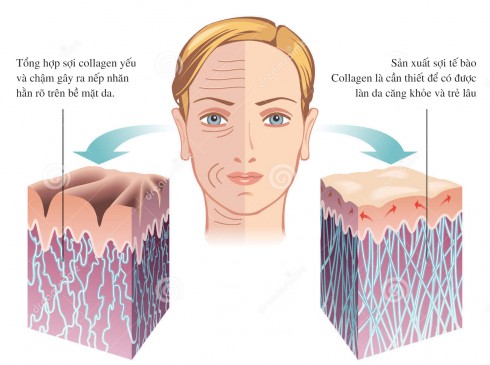 Nên uống collagen loại nào tốt an toàn nhất